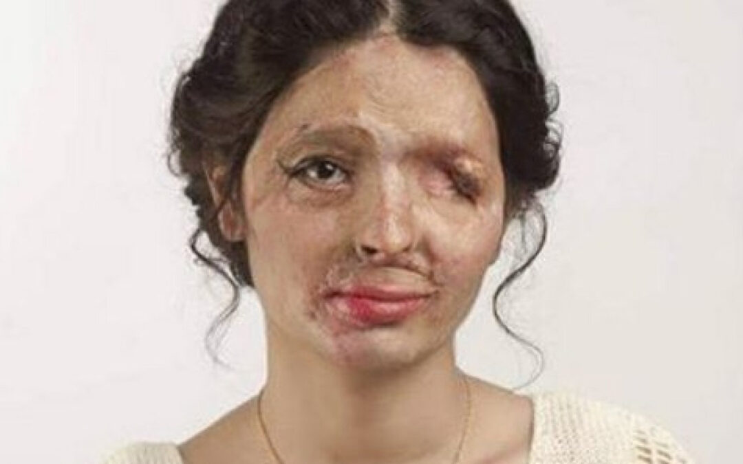 Congreso de Sonora aprueba tipificar como violencia física los ataques con ácido