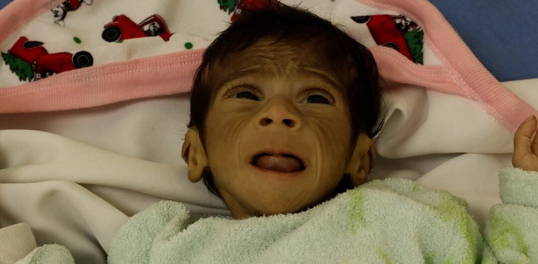 La OMS alerta sobre una “hambruna masiva” en Gaza