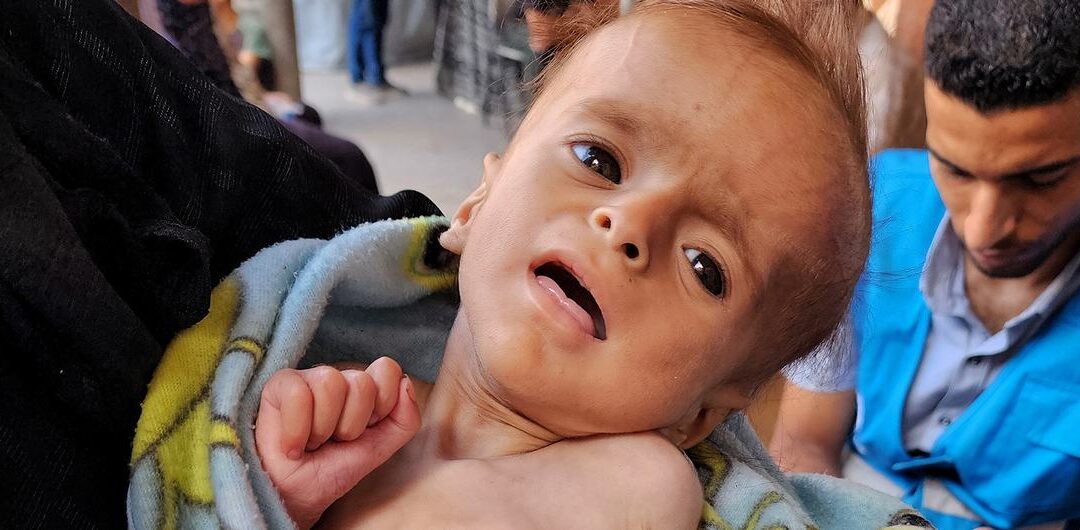 Gaza: La situación es más que catastrófica