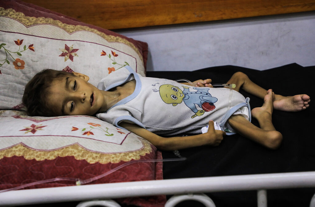 Gaza: Los hospitales están desbordados de heridos y las enfermedades raras empieza a surgir