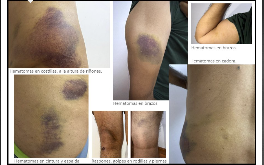 «El peor día de mi vida»: Israel tortura a miembros de la Flotilla de ayuda humanitaria