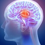 Dos de cada cinco personas en las Américas viven con un trastorno neurológico cerebro